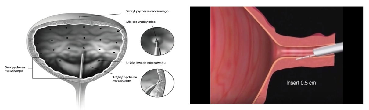 endoskopowe2